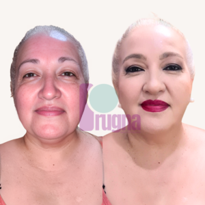 SKIN CONFIDENCE PROGRAM: imagen 9