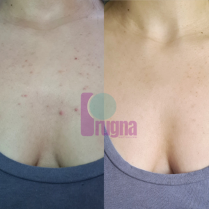 EXPERIENCIA RITUAL PIEL REAL: imagen 3