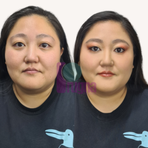 SKIN CONFIDENCE PROGRAM: imagen 4