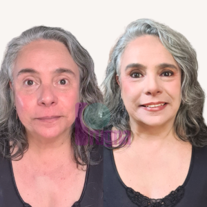 SKIN CONFIDENCE PROGRAM: imagen 2