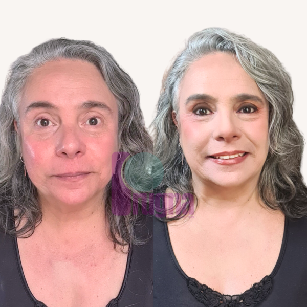 SKIN CONFIDENCE PROGRAM