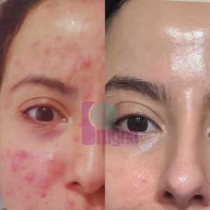 PACK PIEL NUEVA: imagen 3