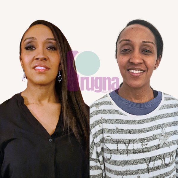 SKIN CONFIDENCE PROGRAM