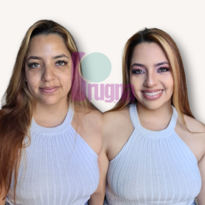 SKIN CONFIDENCE PROGRAM: imagen 8