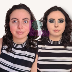 SKIN CONFIDENCE PROGRAM: imagen 7