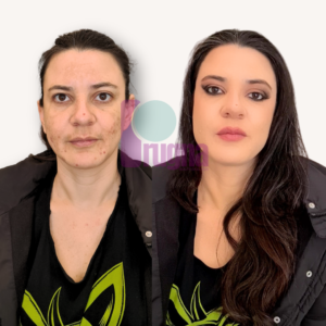 SKIN CONFIDENCE PROGRAM: imagen 6