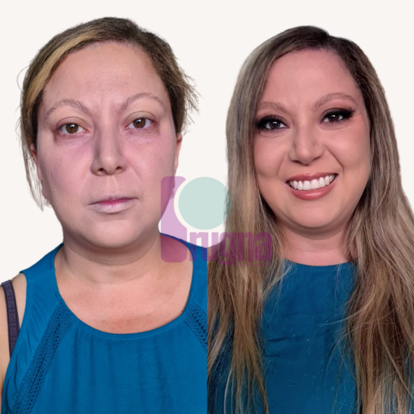 SKIN CONFIDENCE PROGRAM