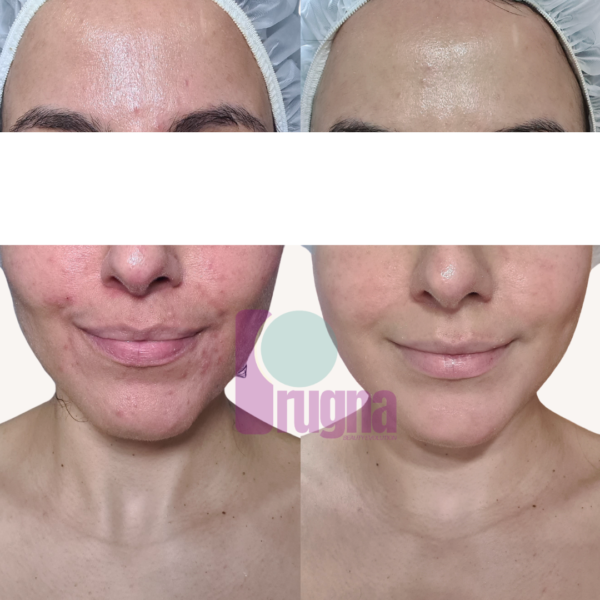 EXPERIENCIA RITUAL PIEL REAL